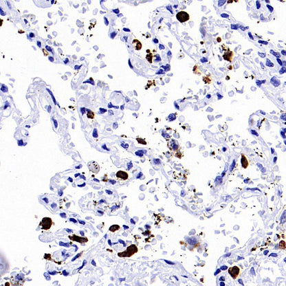 Prosurfactant Protein C Recombinant Rabbit mAb (S-1773-6)