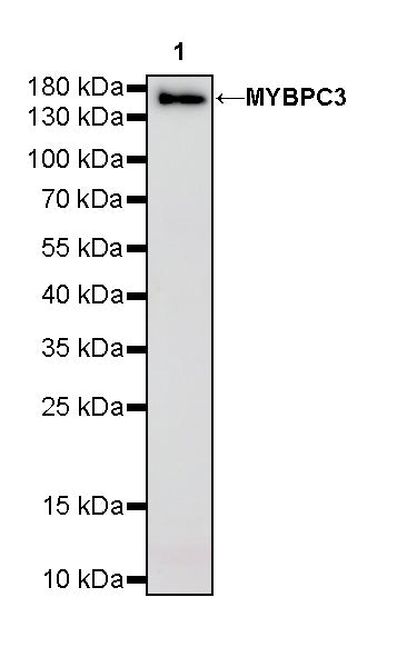MYBPC3 Recombinant Rabbit mAb (S-5476)