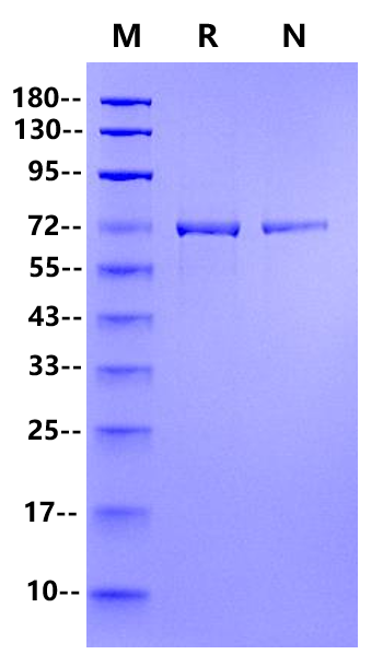 T4 RNA Ligase 1