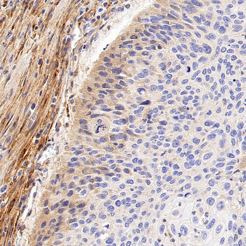 MMP2 Recombinant Rabbit mAb (S-1804-55)