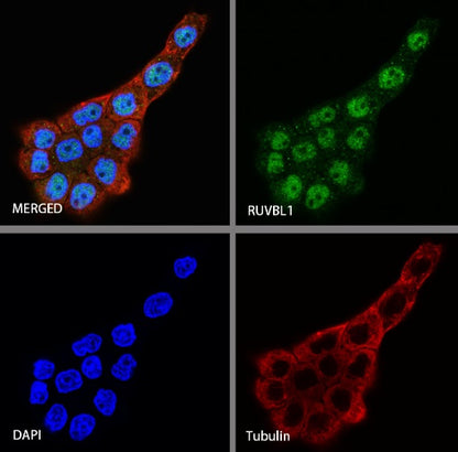 RUVBL1 Recombinant Rabbit mAb (S-1600-38)