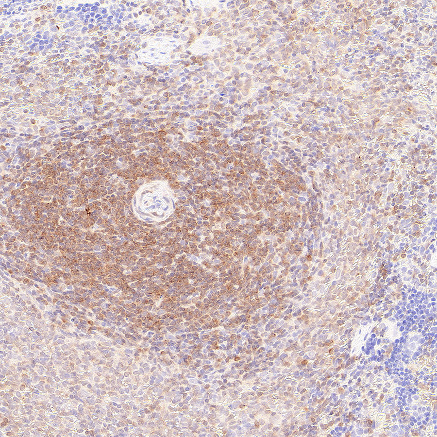 Bcl-2 Recombinant Rabbit mAb (S-3910-3)