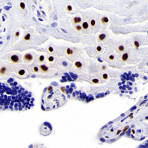 p57 Recombinant Rabbit mAb (SDT-191-79)