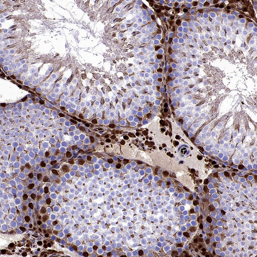 TKT Rabbit Polyclonal Antibody