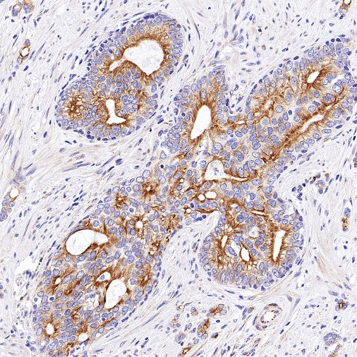 Beta II tubulin Recombinant Rabbit mAb (S-1055-2)