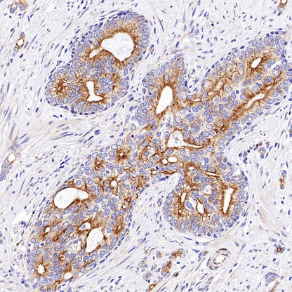 Beta II tubulin Recombinant Rabbit mAb (S-1055-2)