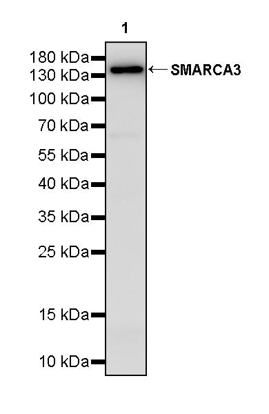 SMARCA3 Recombinant Rabbit mAb (S-3575-154)