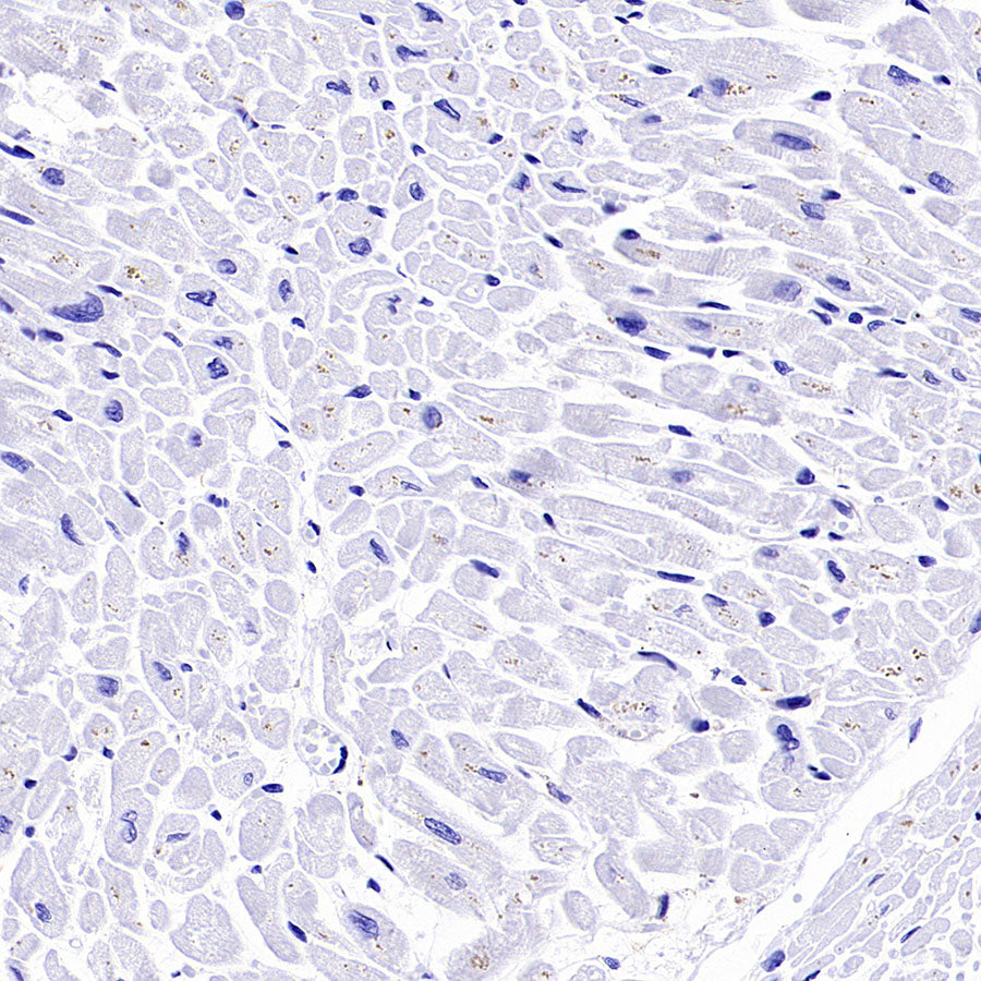 PTK7 Recombinant Rabbit mAb (SDT-2432-156)