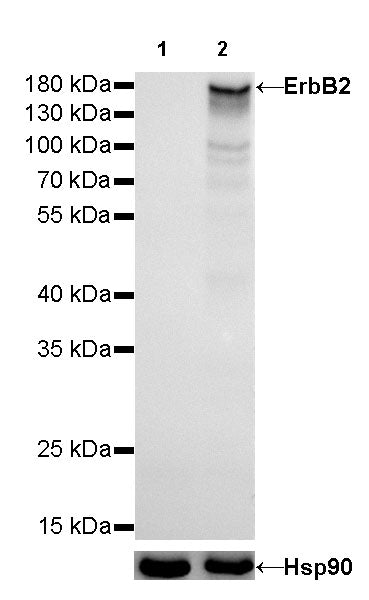 ErbB2 Recombinant Rabbit mAb (SDT-069-10)