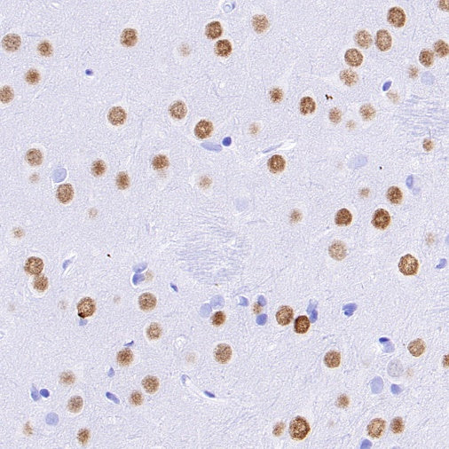 Ctip2 Recombinant Rabbit mAb (S-1375-21)