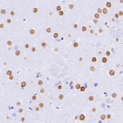 Ctip2 Recombinant Rabbit mAb (S-1375-21)