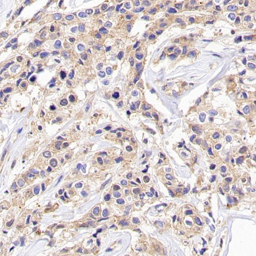 SIDT2 Recombinant Rabbit mAb (S-3763-76)