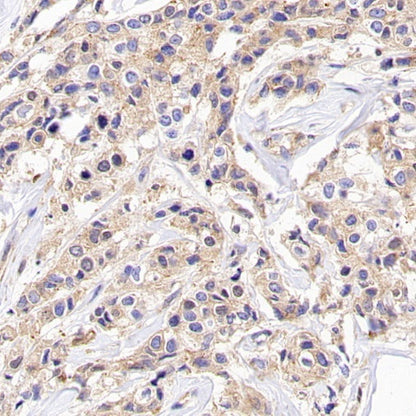 SIDT2 Recombinant Rabbit mAb (S-3763-76)