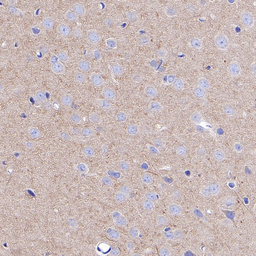 Beta II tubulin Rabbit polyclonal antibody