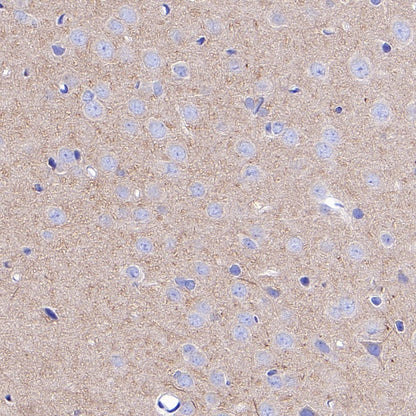 Beta II tubulin Rabbit polyclonal antibody