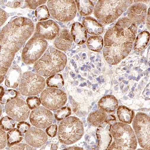DLST Recombinant Rabbit mAb (S-2283-10)
