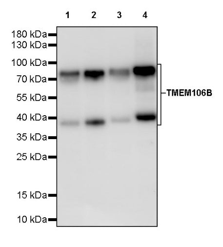 TMEM106B Recombinant Rabbit mAb (S-2362-33)