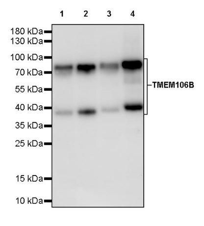 TMEM106B Recombinant Rabbit mAb (S-2362-33)