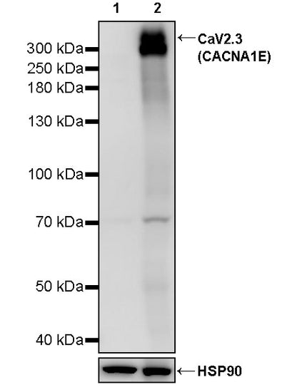 CaV2.3 (CACNA1E) Recombinant Rabbit mAb (S-3244-59)