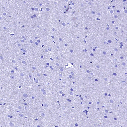 MYO7A Recombinant Rabbit mAb (S-2284-21)