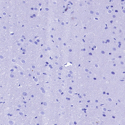 MYO7A Recombinant Rabbit mAb (S-2284-21)
