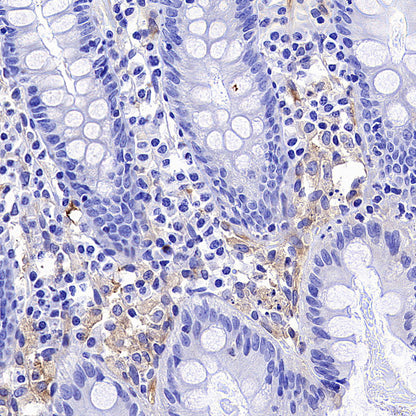 IFIT1 Recombinant Rabbit mAb (S-5120)