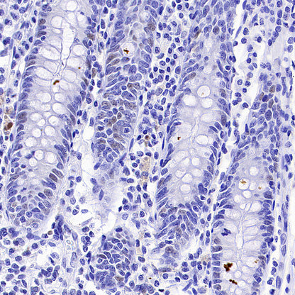 Cyclin E2 Recombinant Rabbit mAb (S-5247)