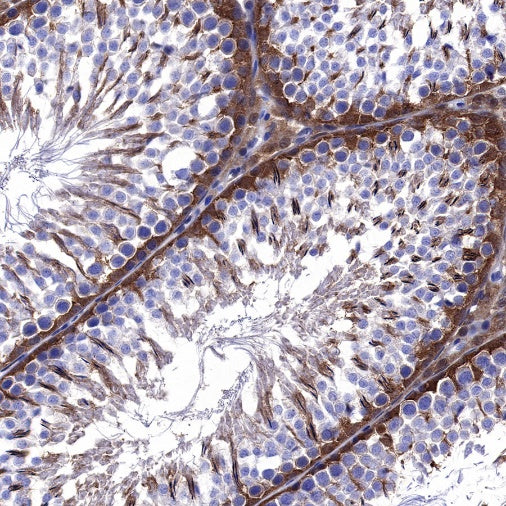 SH-PTP2 Recombinant Rabbit mAb (S-1318-2)