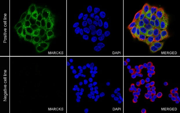 MARCKS Recombinant Rabbit mAb (S-3190-72)