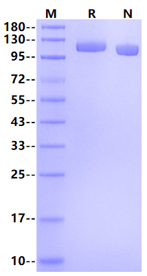 ROBO1/DUTT1 His Tag Protein, Human