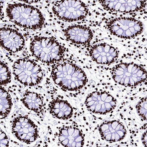 Histone H3 (tri methyl K9) Recombinant Rabbit mAb (S-3826)