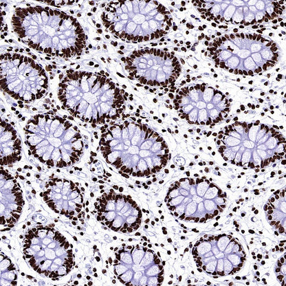 Histone H3 (tri methyl K9) Recombinant Rabbit mAb (S-3826)