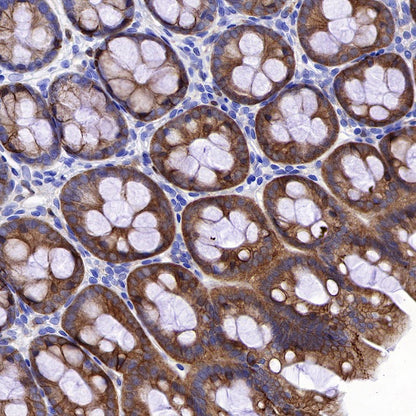 NDRG1 Recombinant Rabbit mAb (S-623-82)