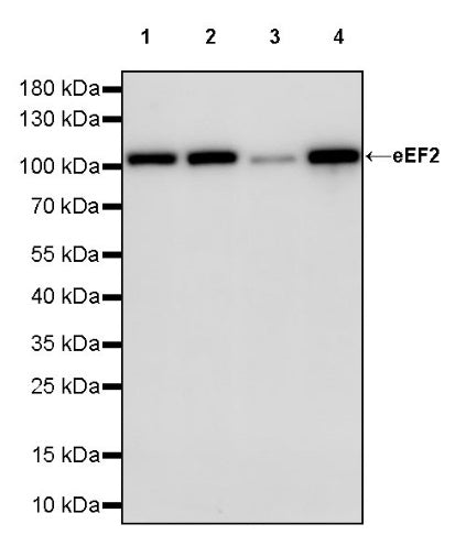 eEF2 Recombinant Rabbit mAb (S-1976-35)