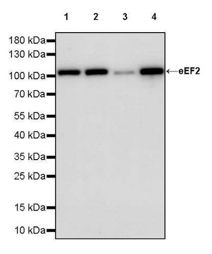 eEF2 Recombinant Rabbit mAb (S-1976-35)