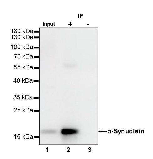 α-Synuclein Recombinant Rabbit mAb (S-441-86)
