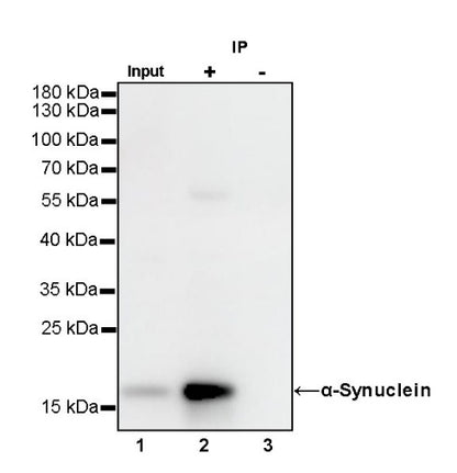 α-Synuclein Recombinant Rabbit mAb (S-441-86)