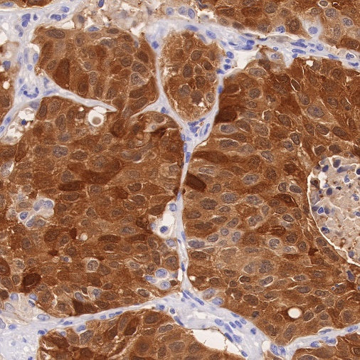 ALDH3A1 Recombinant Rabbit mAb (S-R220)