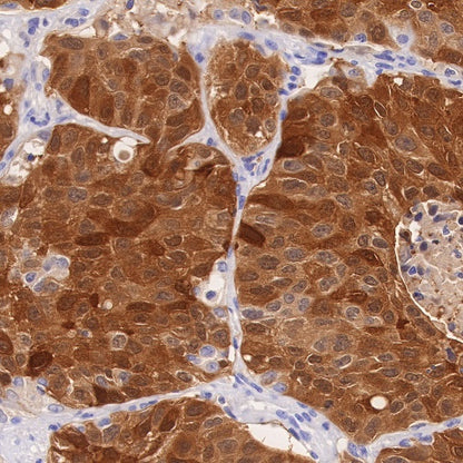 ALDH3A1 Recombinant Rabbit mAb (S-R220)