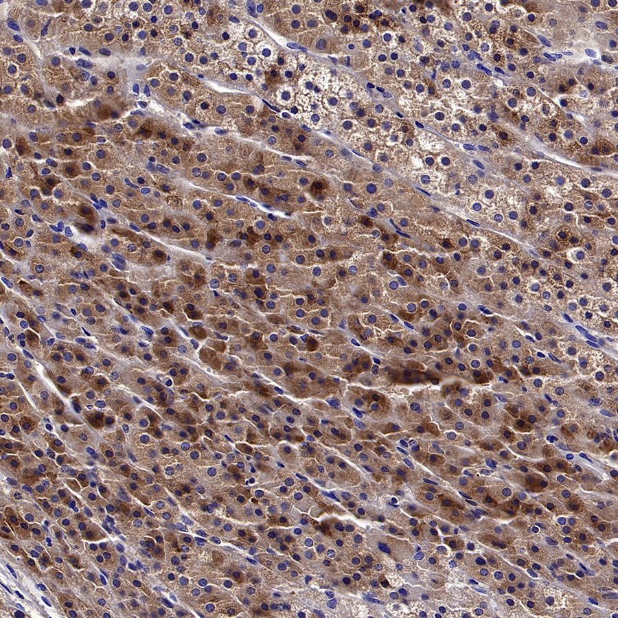 Inhibin alpha Recombinant Rabbit mAb (SDT-3212-24)