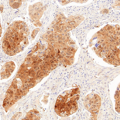 AK1C3 Rabbit Polyclonal Antibody