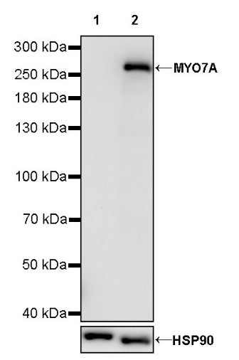 MYO7A Recombinant Rabbit mAb (S-2284-21)