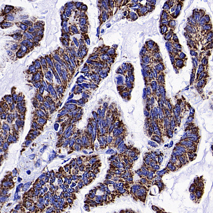 ATPIF1 Recombinant Rabbit mAb (S-3849-49)