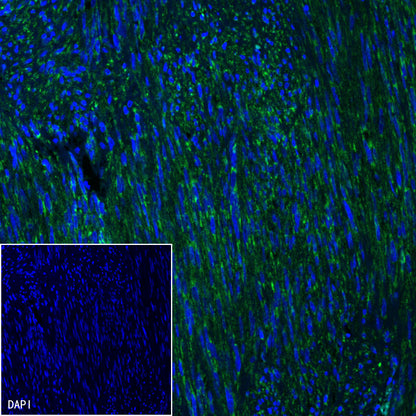 SDHB Recombinant Rabbit mAb (SDT-1162-2)