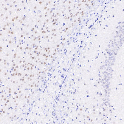 LMO4 Recombinant Rat mAb (S-5963)
