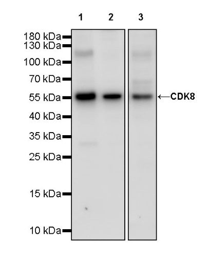 CDK8 Recombinant Rabbit mAb (S-1627-70)