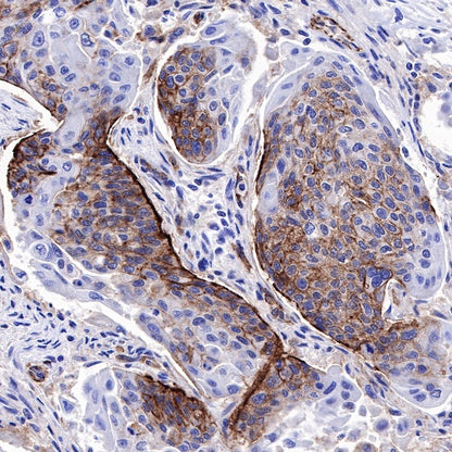 CD49f Recombinant Rabbit mAb (S-1019-73)