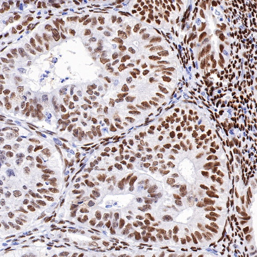 Estrogen Receptor α Recombinant Rabbit mAb (SDT-R371)