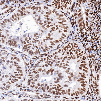 Estrogen Receptor α Recombinant Rabbit mAb (SDT-R371)
