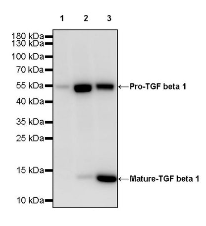 TGF beta 1 Recombinant Rabbit mAb (S-3204)
